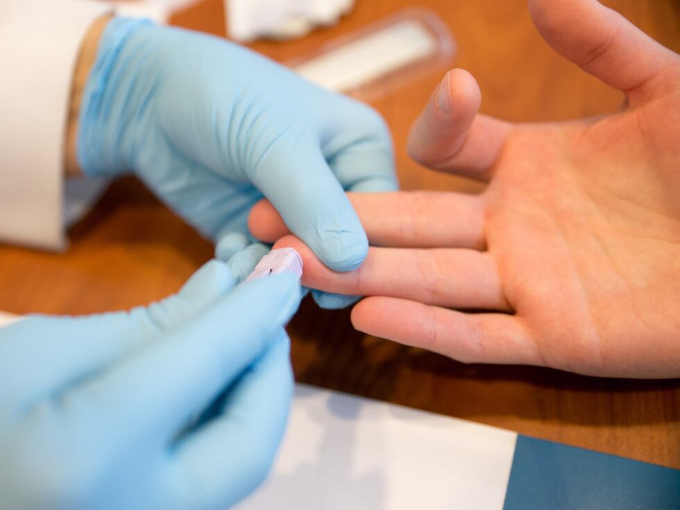 Detección precoz y prueba rápida: cómo romper la cadena de infección del  VIH | VIHda Positiva | EL PAÍS