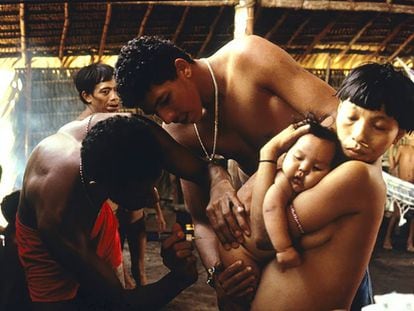Doctor examina a bebé yanomami enfermo, Balaú, 1996.
 