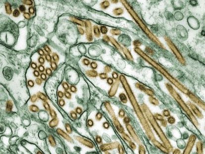 Micrograf&iacute;a del virus de la gripe aviar N5H1 (en color dorado) en un cultivo de c&eacute;lulas (en verde).