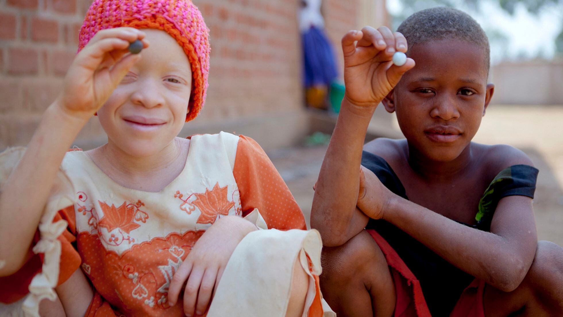 La maldición de las albinas (y los albinos) | Mujeres | EL PAÍS