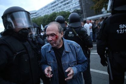 Un manifestante de ultraderecha herido tras un enfrentamiento, es escoltado por la policía.