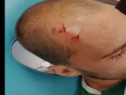 Bas Dost, herido, en el vestuario.