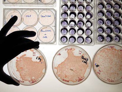 Placas de Petri con cultivos de células.