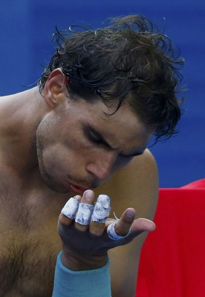 Nadal se sopla las ampollas de la mano durante el partido.