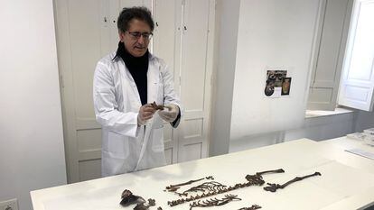Parte de los restos óseos del cadáver de la niña hallado en el Alcázar en abril de 2021, presentados el jueves en Sevilla.