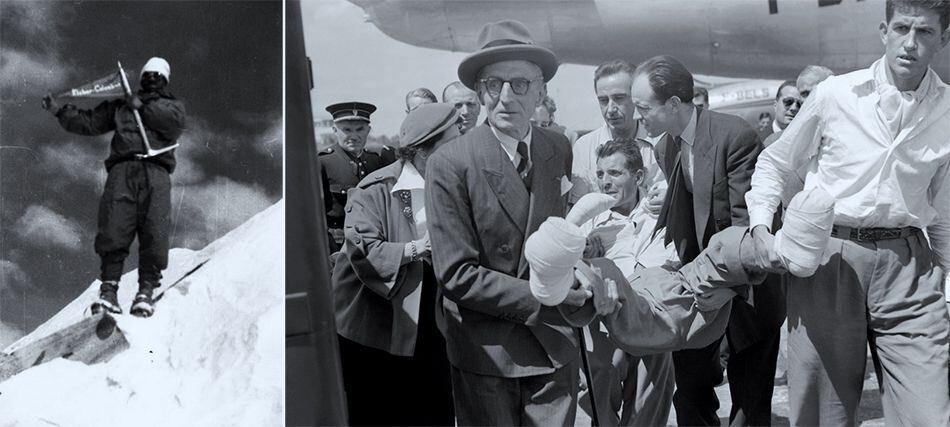 Maurice Herzog, tras coronar por primera vez el Annapurna en 1950. A la derecha, a su regreso a París con graves heridas en manos y pies.