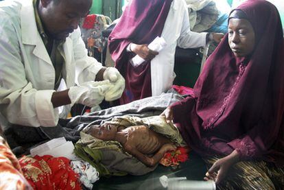 Un médico prepara alimentación por vía nasal para un niño de tres años en el hospital de Banadir, en Mogadiscio.