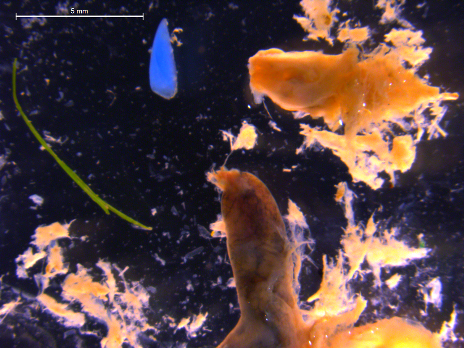 Un microplástico (en azul) encontrado en una anchoa.
