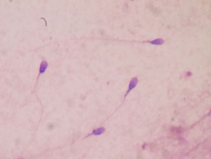 Espermatozoides humanos vistos al microscopio