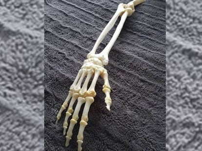 El brazo esqueletizado tras pasar por un proceso de limpieza.