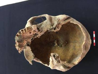 El crani que s'atribueix a Arnau de Torroja