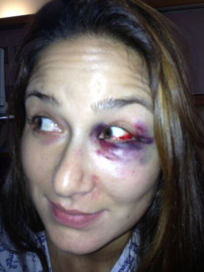 Pilar Gómez, tras ser asaltada.