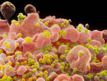 Imatge microscòpica del virus del VIH.
