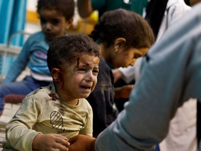 Niños palestinos heridos en un ataque israelí, este domingo en el hospital Nasser, en Gaza.