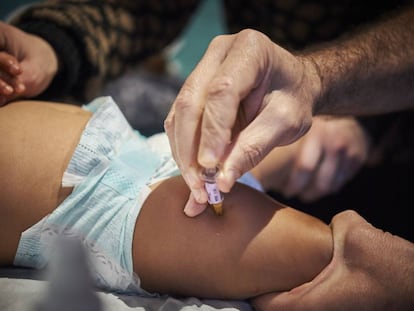 Un pediatra vacuna a un bebé en Francia.