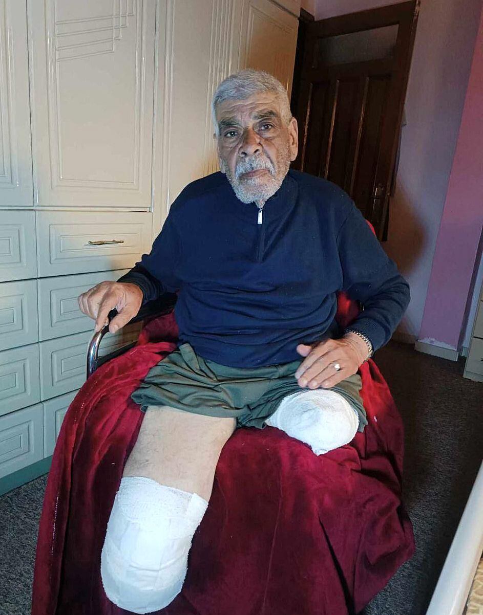 Sami Mushtaha, de 85 años, en una imagen cedida por su familia. Al anciano le amputaron ambas piernas después de resultar herido en el bombardeo de su casa en Gaza. Ese ataque mató a tres de sus nietos, de entre 14 y 18 años.