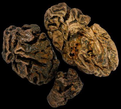 Fragmentos del cerebro de un individuo enterrado en Bristol (Reino Unido) hace más de 200 años. Ningún otro tejido blando se ha conservado.