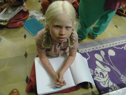 Una niña albina con un libro de escritura braille en su regazo en la escuela de Primaria con menores invidentes en B.K. Samudran (India). Las personas albinas están marginadas de esta sociedad, por lo que la Fundación Vicente Ferrer las acoge de forma permante en sus instalaciones.