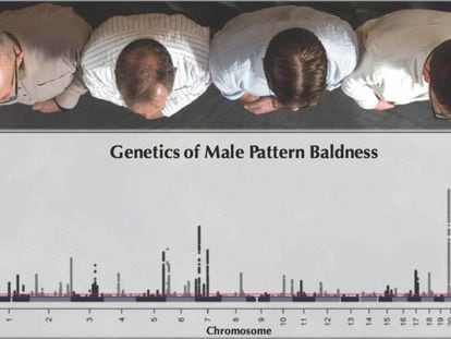 Patrones genéticos de la calvicie en los hombres, según el estudio.