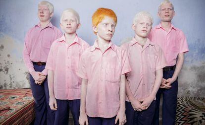 Adolescentes indios, albinos e invidentes, en una fotograía de Brent Stirton que ha obtenido el primer premio de retratos.