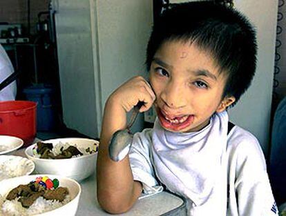 Un niño, víctima del arma tóxica, desayuna en el hospital Ho Chi Minh.