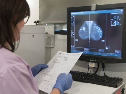 Una médico con una mamografía.