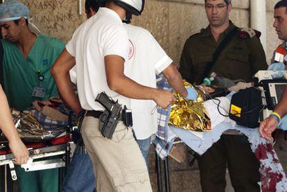 Médicos de un hospital de Jerusalén atienden a uno de los policías israelíes heridos en una emboscada cerca de Hebrón.