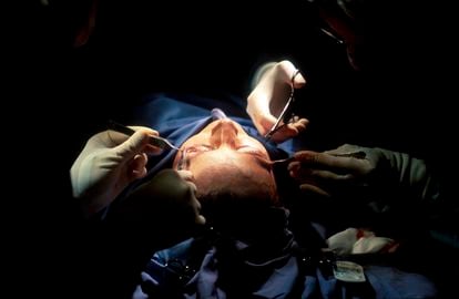 Cuáles son las intervenciones de cirugía plástica más demandadas?