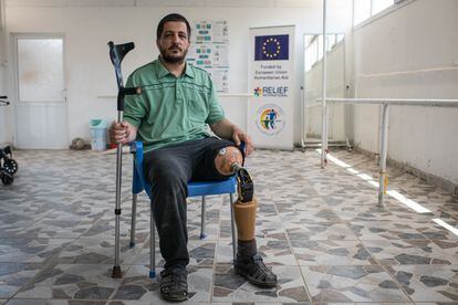 Walid Hadid, a Syrian refugee from Homs, posed on June 1 at a rehabilitation center in Reyhanli, Turkey.