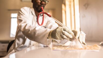 Selección de mosquitos para su estudio, usando un aspirador bucal, en el laboratorio del Ministerio de Ciencia (Kigali, Ruanda).