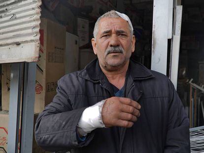 Mehmet Gürler, herido tras explotar un proyectil lanzado desde Siria por las milicias kurdas YPG en la localidad turca de Reyhanli. Una persona murió y una cincuentena sufrieron heridas de diversa consideración tras caer once proyectiles en Reyhanli este domingo. En vídeo, declaraciones del portavoz del Gobierno turco.