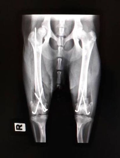 Radiografía de las patas traseras de la perra 'Katalina', operada en el hospital Rof Codina de Lugo.