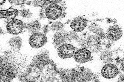 Una imagen con microscopio electrónico del coronavirus que sufrió el primer paciente de covid-19 en EE UU.