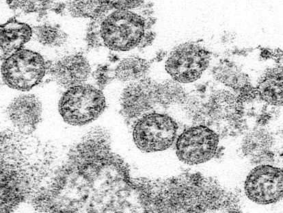 Una imagen con microscopio electrónico del coronavirus que sufrió el primer paciente de covid-19 en EE UU.