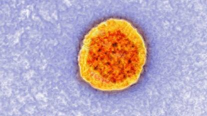 Imagen tomada con un microscopio del virus de la hepatitis C. 