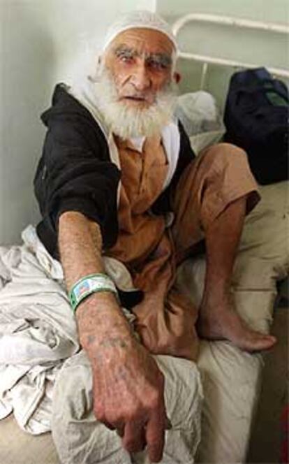 Uno de los liberados, Faiz Muhammad, ayer en un hospital de Kabul.