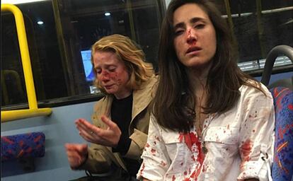 Melania Geymonat (à direita) e sua namorada, Chris, depois da agressão que sofreram em um ônibus de Londres em 30 de maio.