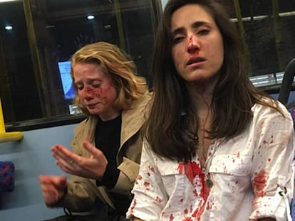 Melania Geymonat (à direita) e sua namorada, Chris, depois da agressão que sofreram em um ônibus de Londres em 30 de maio.