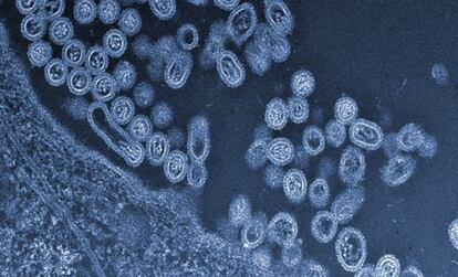 Virus de la gripe aviar, H7N9, saliendo de una célula.