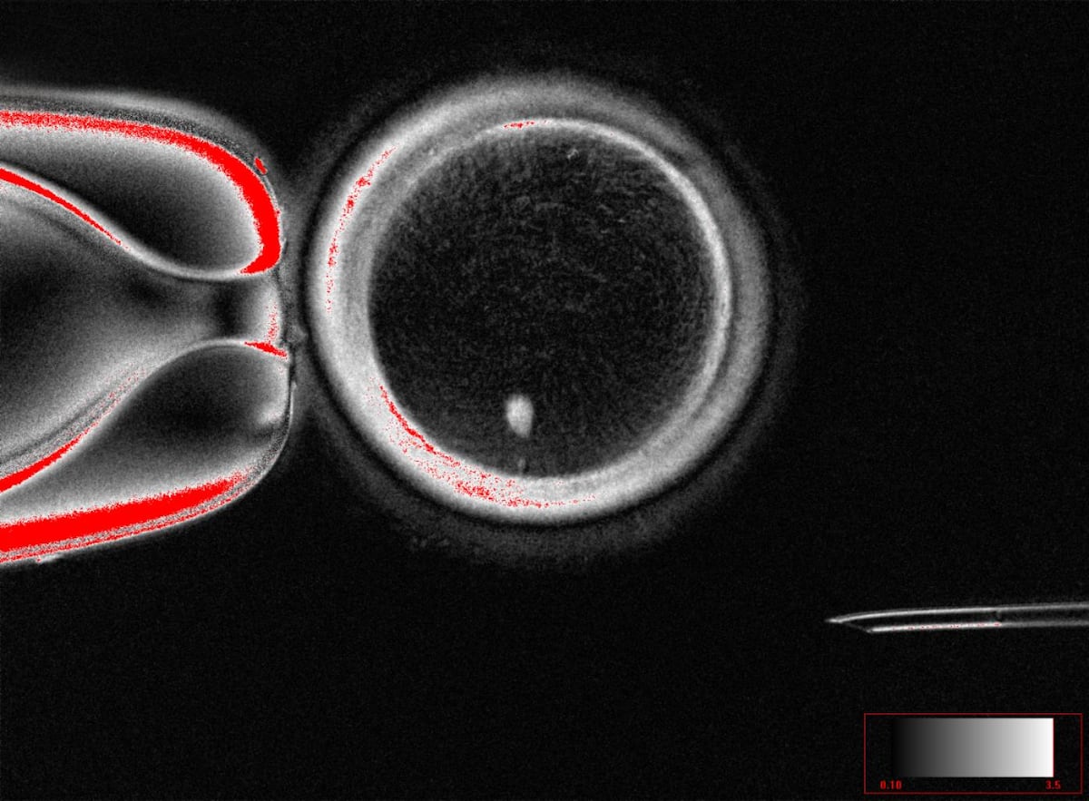 Fertilizable human eggs created from skin cells using the technique that cloned Dolly the sheep