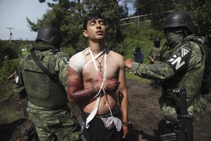 Un herido por una balacera en Michoacán el 3 de septiembre.
