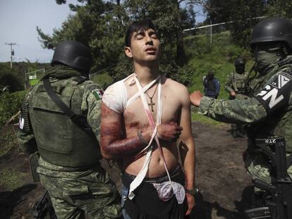 Un herido por una balacera en Michoacán el 3 de septiembre.
