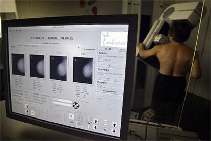 Prueba de mamografía a una paciente del hospital del Mar de Barcelona.