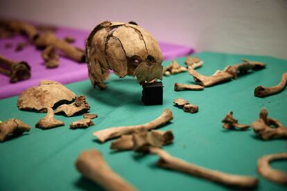 Detalle de los restos encontrados de un niño en la fosa.