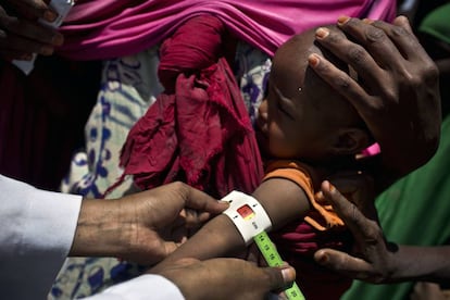 Una cl&iacute;nica m&oacute;vil en el campo de desplazados de Ainabo, en Somalia.