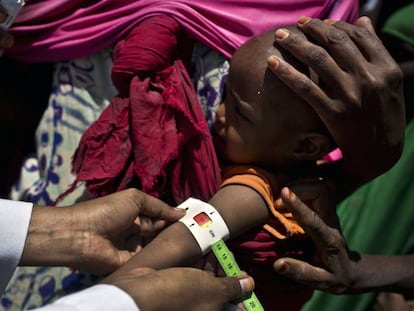 Una cl&iacute;nica m&oacute;vil en el campo de desplazados de Ainabo, en Somalia.