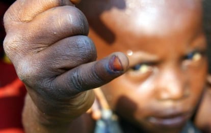 Un niño muestra su uña pintada que indica que ya ha sido inmunizado contra la polio, en República Democrática del Congo.