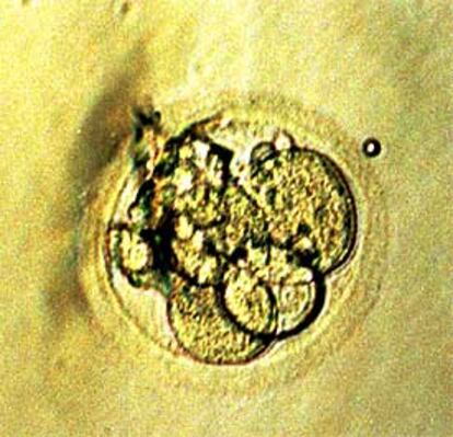 Un embrión humano clónico obtenido en el hospital Kyonghee de Seúl, en la fase de cuatro células.
