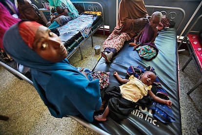 Niños famélicos en el hospital de Benadir. Más de 30.000 han muerto a lo largo de tres meses por el azote de la hambruna.