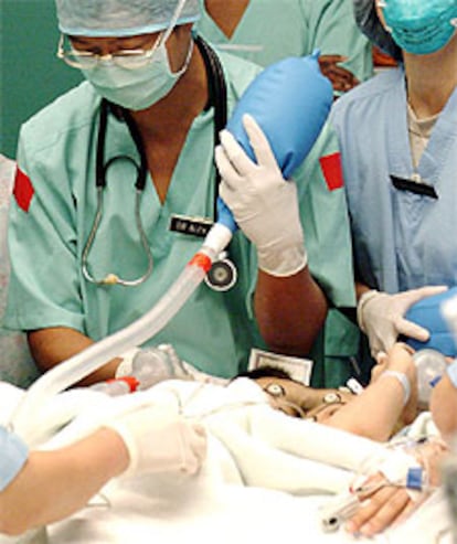 Varios cirujanos administran anestesia a las siamesas durante la operación.